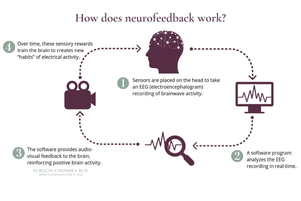 Neurofeedback